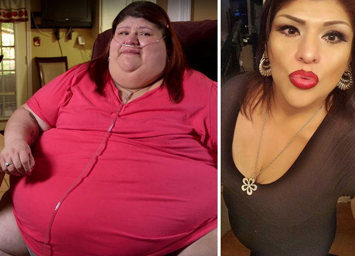 25 Unbelievable Before & After Transformation Pics From ‘My 600 Lb Life’ 25 Unbelievable Before & After Transformation Pics From ‘My 600 Lb Life’