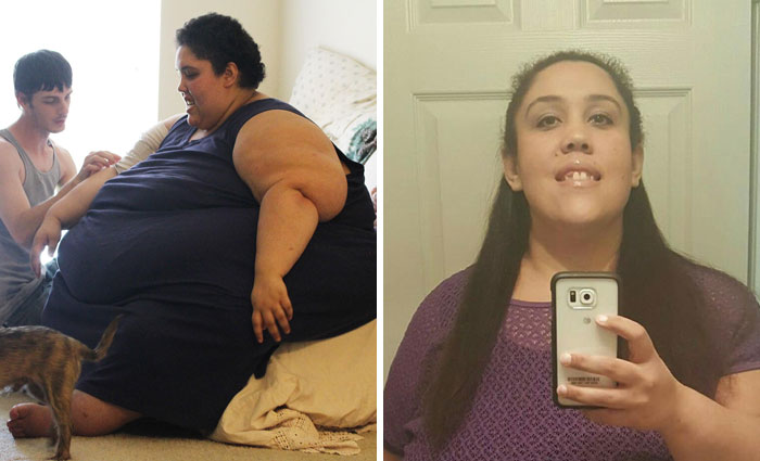 25 Unbelievable Before & After Transformation Pics From ‘My 600 Lb Life’ 25 Unbelievable Before & After Transformation Pics From ‘My 600 Lb Life’