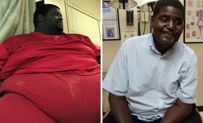 25 Unbelievable Before & After Transformation Pics From ‘My 600 Lb Life’ 25 Unbelievable Before & After Transformation Pics From ‘My 600 Lb Life’