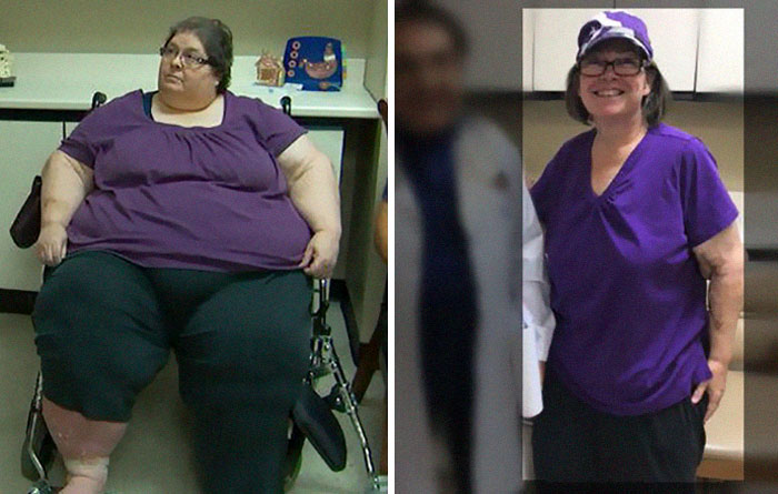 25 Unbelievable Before & After Transformation Pics From ‘My 600 Lb Life’ 25 Unbelievable Before & After Transformation Pics From ‘My 600 Lb Life’