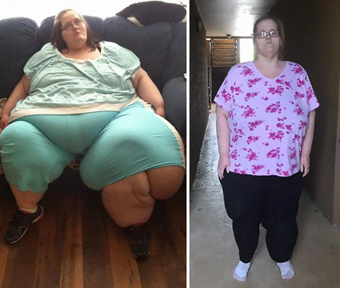 25 Unbelievable Before & After Transformation Pics From ‘My 600 Lb Life’ 25 Unbelievable Before & After Transformation Pics From ‘My 600 Lb Life’
