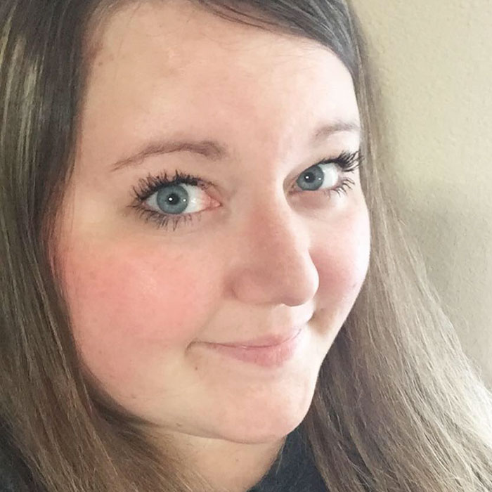 Bullied 7 Year-Old Finds Cat With Same Rare Eye Condition And Cleft Lip, And It’s Like Destiny Exists Bullied 7 Year-Old Finds Cat With Same Rare Eye Condition And Cleft Lip, And It’s Like Destiny Exists