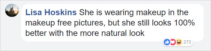 After 20 Years On Stage Using Makeup Christina Aguilera Does A Shoot Without It, And We Can’t Recognize Her After 20 Years On Stage Using Makeup Christina Aguilera Does A Shoot Without It, And We Can’t Recognize Her