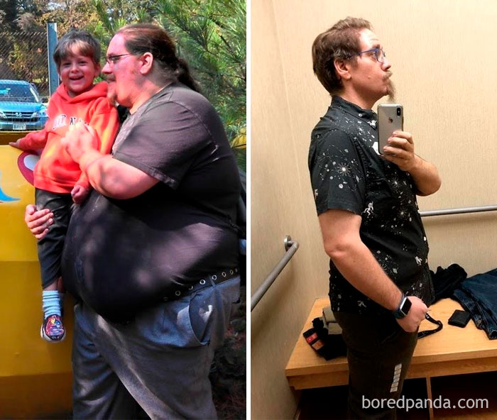 255 Unbelievable Before &#038; After Transformation Pics That Show If They Could Do It, So Can You