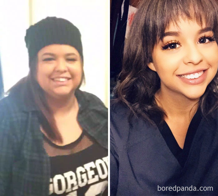 255 Unbelievable Before &#038; After Transformation Pics That Show If They Could Do It, So Can You