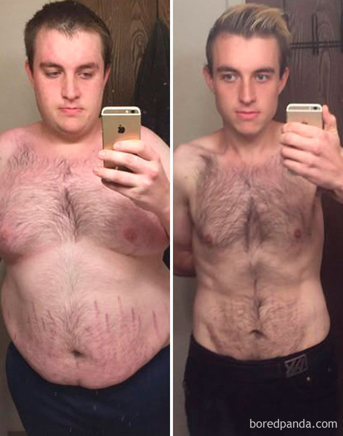 255 Unbelievable Before &#038; After Transformation Pics That Show If They Could Do It, So Can You