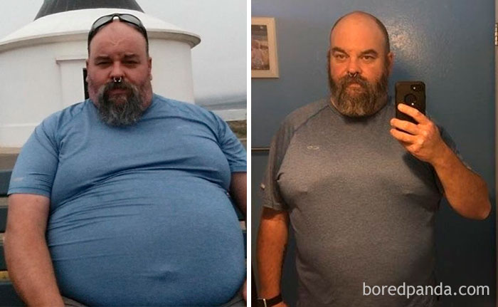 255 Unbelievable Before &#038; After Transformation Pics That Show If They Could Do It, So Can You
