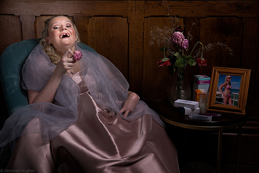 I Photograph People With Rare Diseases To Encourage Others To Want To Know More