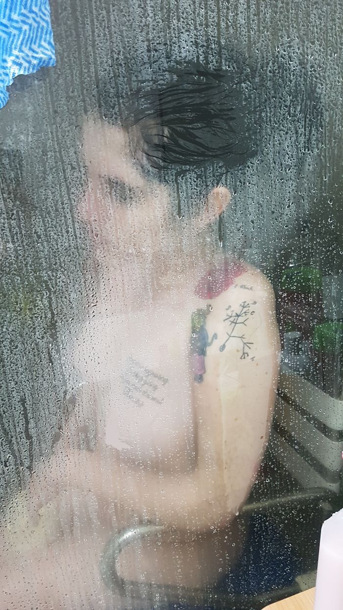 I’m Documenting Myself Slowly Dying From A Rare Disease To Show Why Euthanasia Should Be Legalized I’m Documenting Myself Slowly Dying From A Rare Disease To Show Why Euthanasia Should Be Legalized