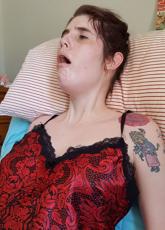 I’m Documenting Myself Slowly Dying From A Rare Disease To Show Why Euthanasia Should Be Legalized I’m Documenting Myself Slowly Dying From A Rare Disease To Show Why Euthanasia Should Be Legalized