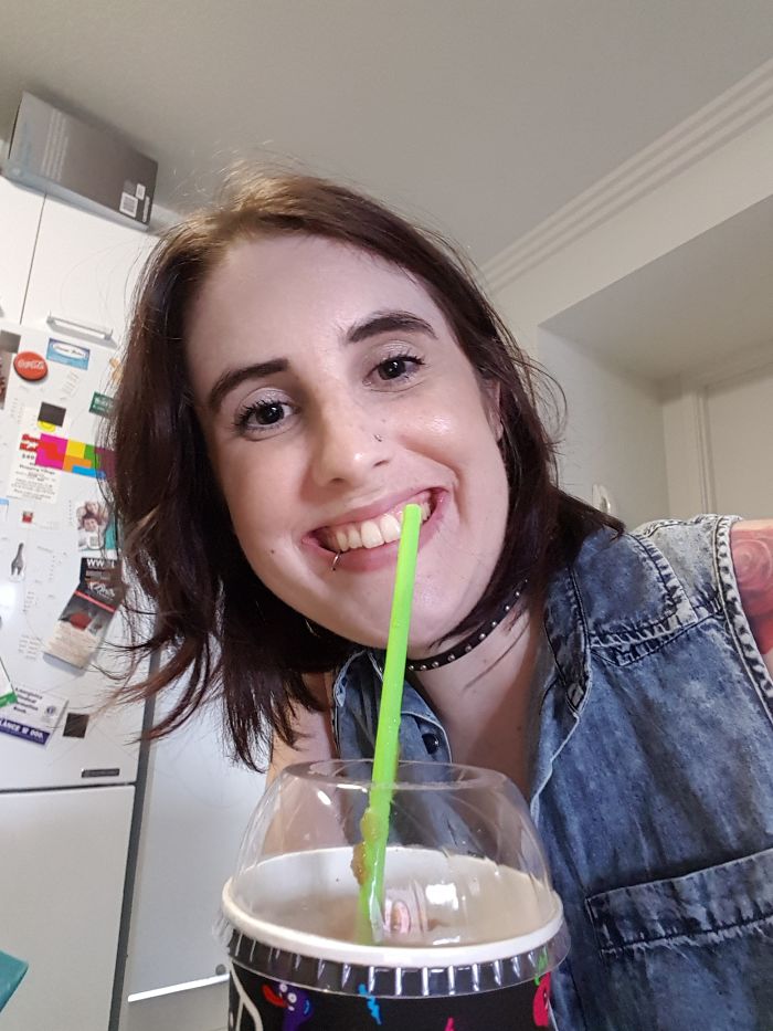 I’m Documenting Myself Slowly Dying From A Rare Disease To Show Why Euthanasia Should Be Legalized I’m Documenting Myself Slowly Dying From A Rare Disease To Show Why Euthanasia Should Be Legalized