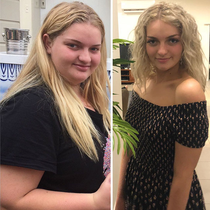Overweight Teenager Surprises Everyone By Losing 139 Lbs To Fit Into Her Formal Dress