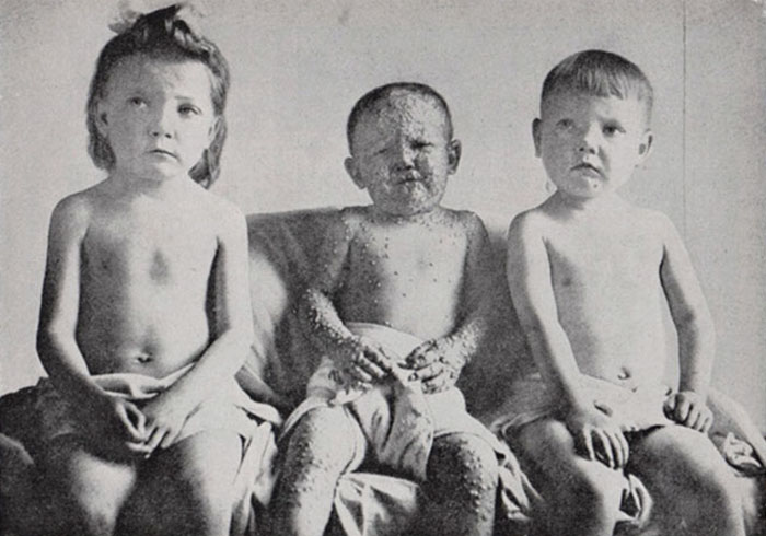 Ben Franklin Has The Best Comeback For Anti-Vaxxers And It Was Written 230 Years Ago