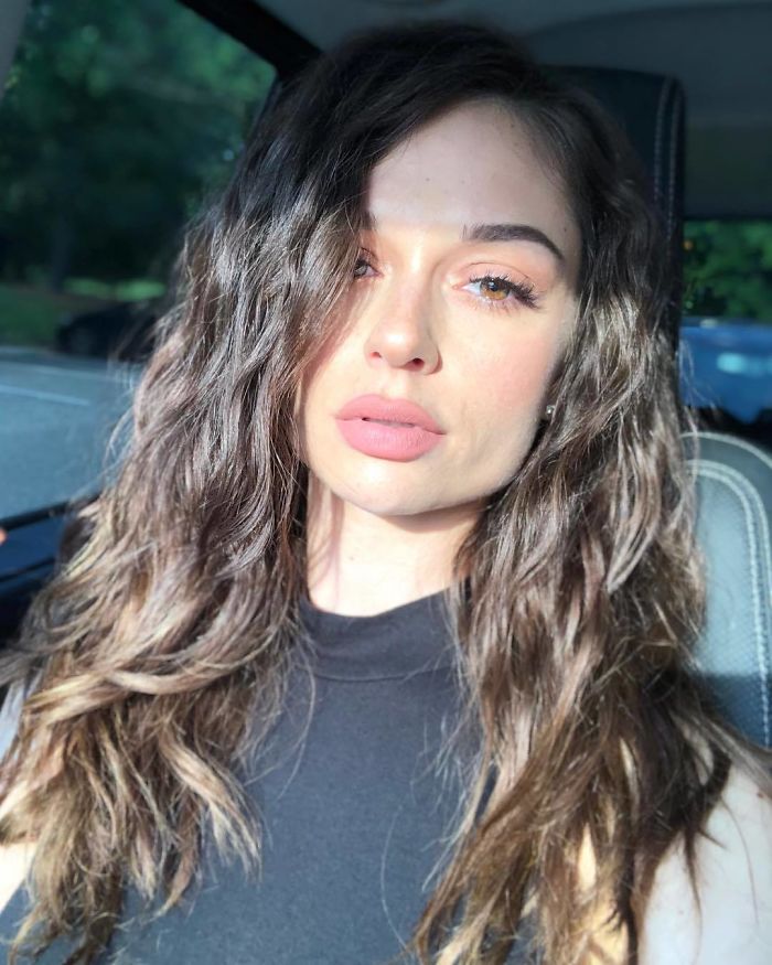 Girl Gets Her Leg Amputated At Age 11 Because Of Cancer, Becomes A Model 20 Years Later Girl Gets Her Leg Amputated At Age 11 Because Of Cancer, Becomes A Model 20 Years Later