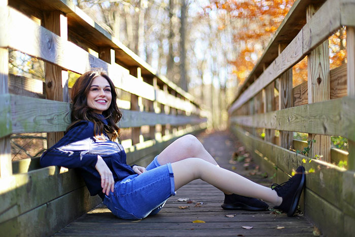 Girl Gets Her Leg Amputated At Age 11 Because Of Cancer, Becomes A Model 20 Years Later Girl Gets Her Leg Amputated At Age 11 Because Of Cancer, Becomes A Model 20 Years Later