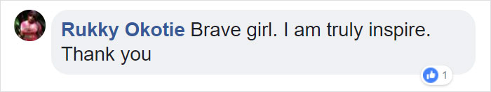 Girl Gets Her Leg Amputated At Age 11 Because Of Cancer, Becomes A Model 20 Years Later Girl Gets Her Leg Amputated At Age 11 Because Of Cancer, Becomes A Model 20 Years Later