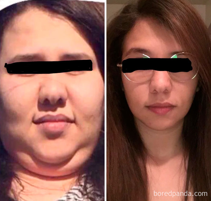 256 Times People Surprised Everyone By Losing So Much Weight They Looked Like A Different Person (New Pics) 256 Times People Surprised Everyone By Losing So Much Weight They Looked Like A Different Person (New Pics)