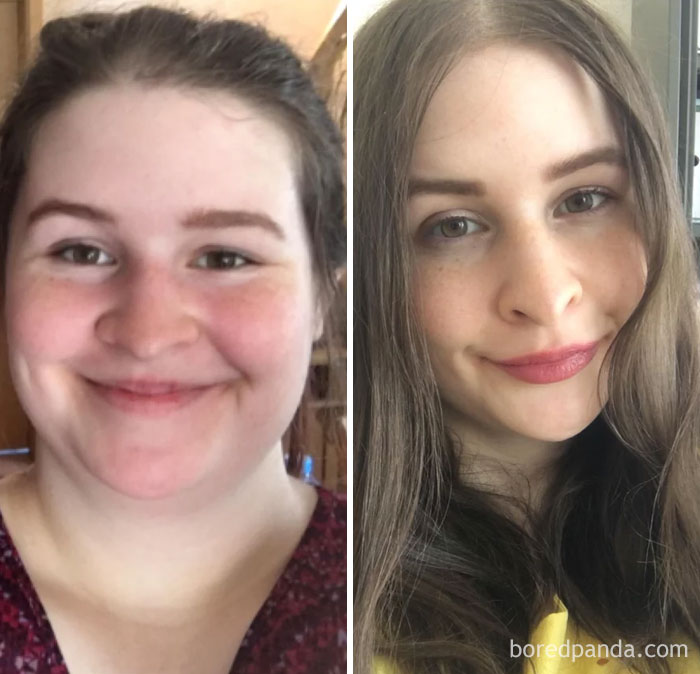 256 Times People Surprised Everyone By Losing So Much Weight They Looked Like A Different Person (New Pics) 256 Times People Surprised Everyone By Losing So Much Weight They Looked Like A Different Person (New Pics)