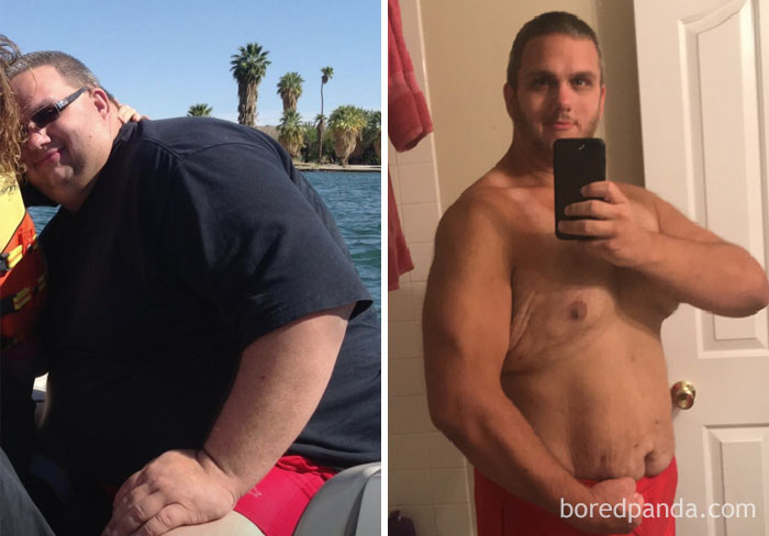 256 Times People Surprised Everyone By Losing So Much Weight They Looked Like A Different Person (New Pics) 256 Times People Surprised Everyone By Losing So Much Weight They Looked Like A Different Person (New Pics)