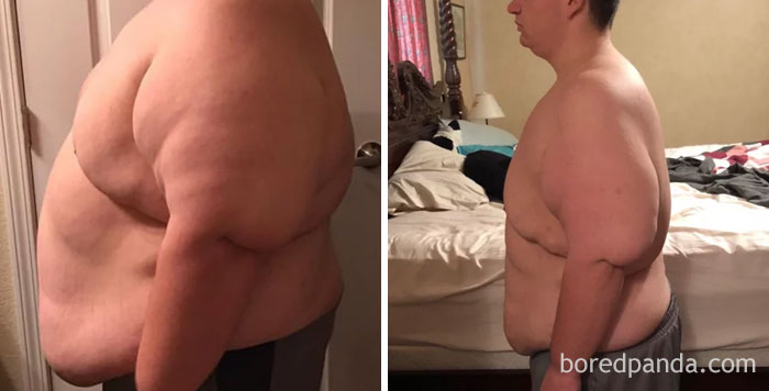 256 Times People Surprised Everyone By Losing So Much Weight They Looked Like A Different Person (New Pics) 256 Times People Surprised Everyone By Losing So Much Weight They Looked Like A Different Person (New Pics)