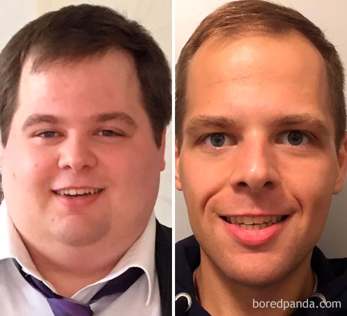 256 Times People Surprised Everyone By Losing So Much Weight They Looked Like A Different Person (New Pics) 256 Times People Surprised Everyone By Losing So Much Weight They Looked Like A Different Person (New Pics)