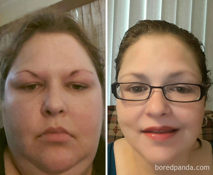 256 Times People Surprised Everyone By Losing So Much Weight They Looked Like A Different Person (New Pics) 256 Times People Surprised Everyone By Losing So Much Weight They Looked Like A Different Person (New Pics)