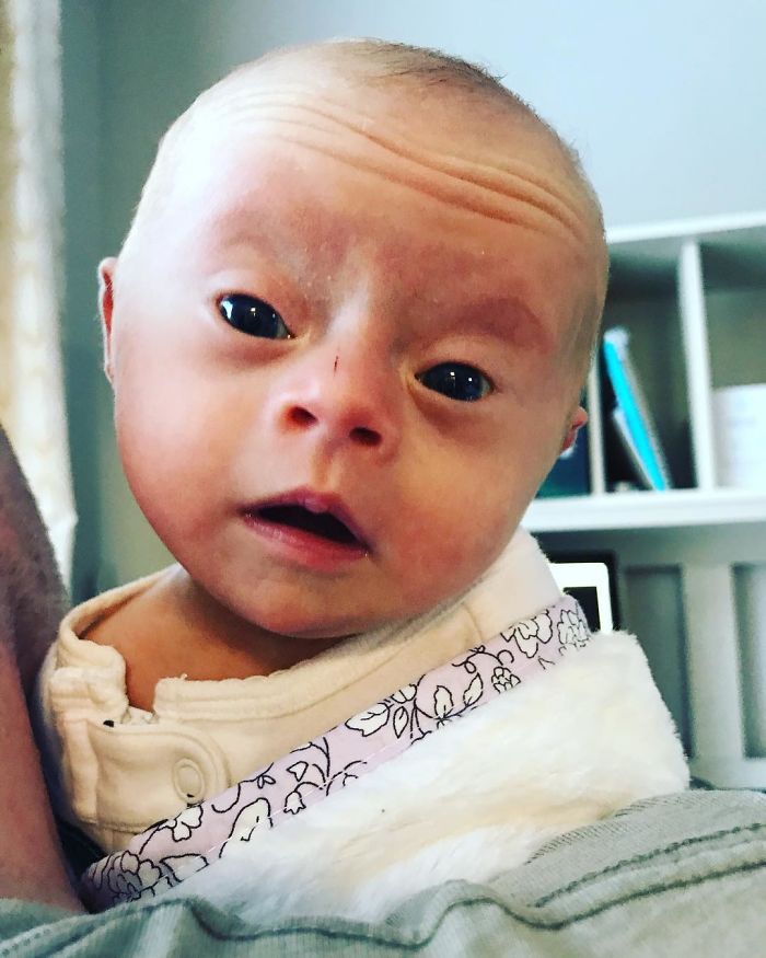 Mom Shares Honest &#8216;Review&#8217; Of Her Baby With Down Syndrome, And 347K People Love It