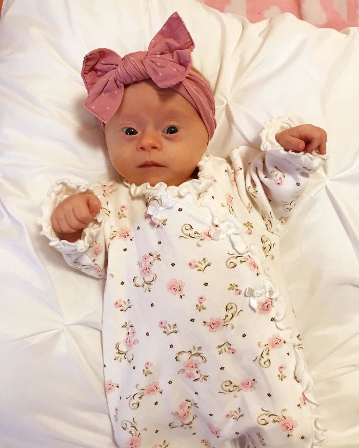 Mom Shares Honest &#8216;Review&#8217; Of Her Baby With Down Syndrome, And 347K People Love It