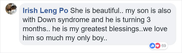 Mom Shares Honest &#8216;Review&#8217; Of Her Baby With Down Syndrome, And 347K People Love It