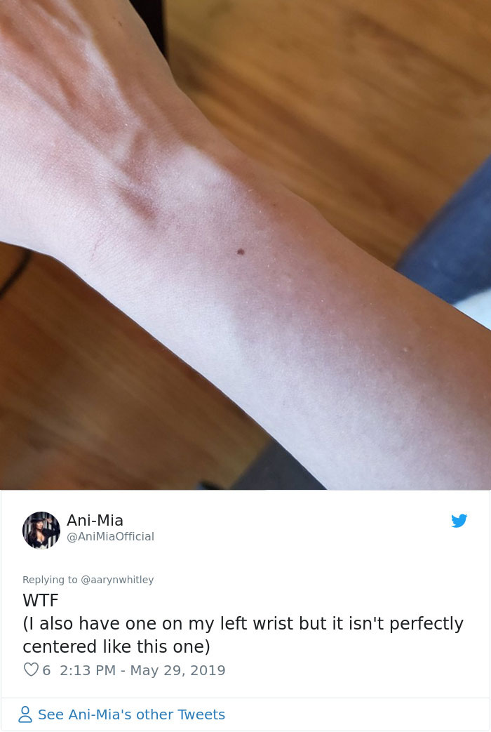 Someone Claims All Women Have A Freckle In The Middle Of Their Wrists, And People Start Freaking Out (23 Pics)