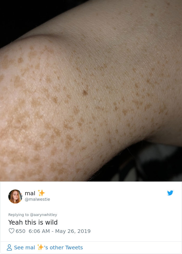 Someone Claims All Women Have A Freckle In The Middle Of Their Wrists, And People Start Freaking Out (23 Pics)