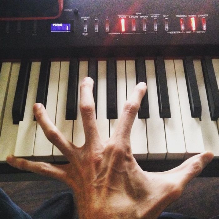 This Man Has A Rare Genetic Condition Which Made Him One Of The Most Sought After Actors In Horror This Man Has A Rare Genetic Condition Which Made Him One Of The Most Sought After Actors In Horror