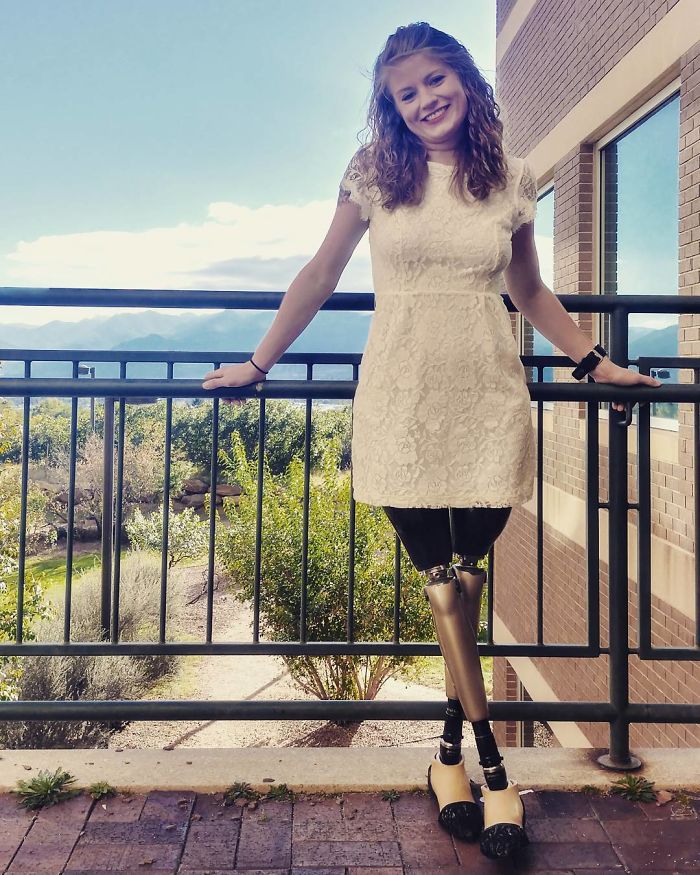 This Woman Lost Both Of Her Legs But Not Her Dark Sense Of Humor, Shows It Off On Tinder This Woman Lost Both Of Her Legs But Not Her Dark Sense Of Humor, Shows It Off On Tinder