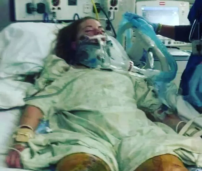 This Woman Lost Both Of Her Legs But Not Her Dark Sense Of Humor, Shows It Off On Tinder This Woman Lost Both Of Her Legs But Not Her Dark Sense Of Humor, Shows It Off On Tinder