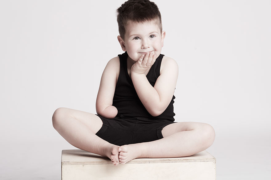 We Photographed 19 People With Limb Differences Aged From 2 To 54 In Body Confidence Shoot We Photographed 19 People With Limb Differences Aged From 2 To 54 In Body Confidence Shoot