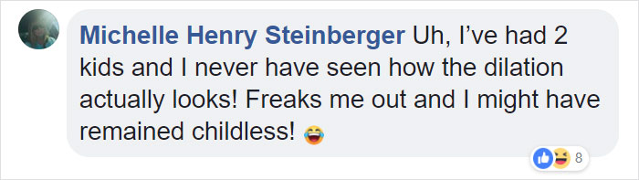 This ‘Dilation Chart’ Helps People Understand That Giving Birth Is Not Just Painful, It’s Hardcore This ‘Dilation Chart’ Helps People Understand That Giving Birth Is Not Just Painful, It’s Hardcore