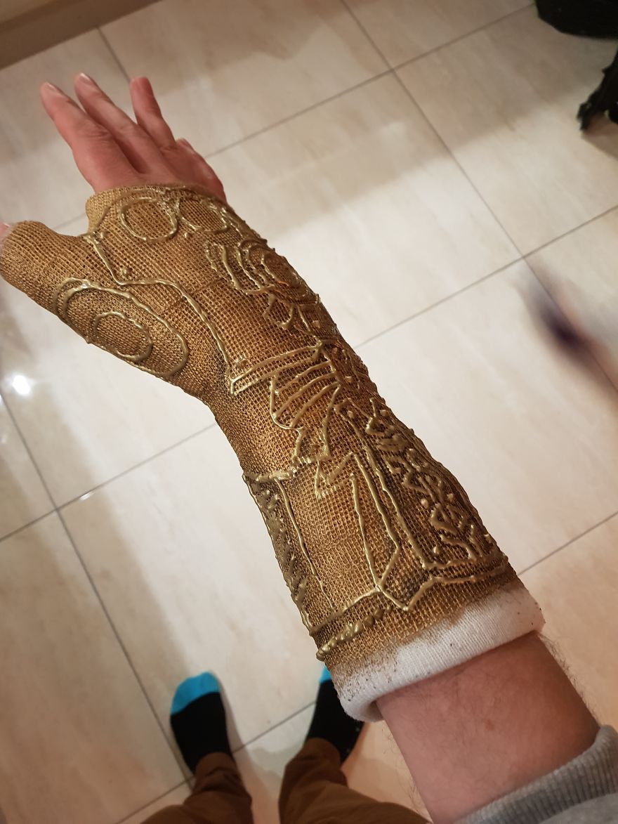 After Breaking My Wrist, I Turned My Plain Cast Into Thanos‘ Infinity Gauntlet After Breaking My Wrist, I Turned My Plain Cast Into Thanos‘ Infinity Gauntlet