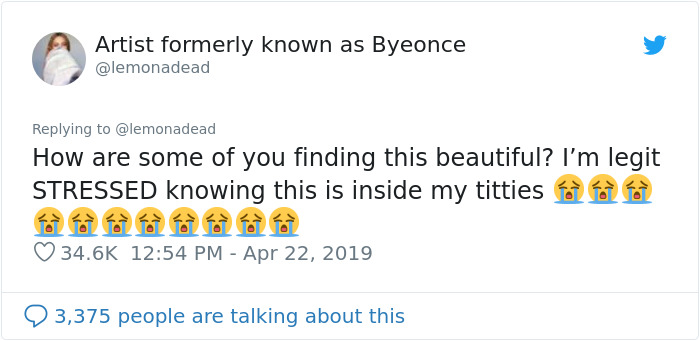 People Can’t Believe This Photo Of Female Milk Glands Is Real People Can’t Believe This Photo Of Female Milk Glands Is Real