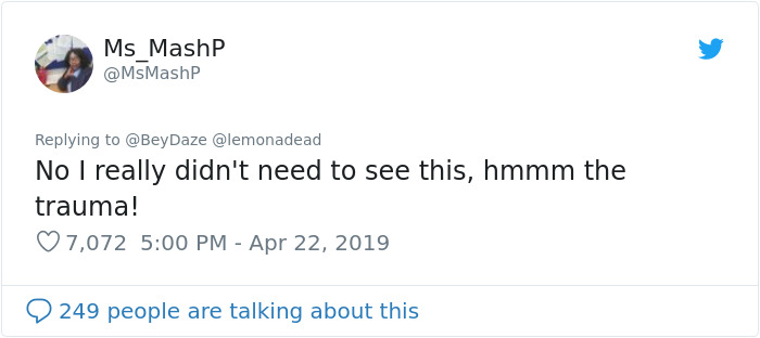 People Can’t Believe This Photo Of Female Milk Glands Is Real People Can’t Believe This Photo Of Female Milk Glands Is Real