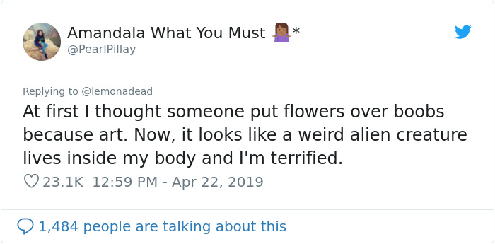 People Can’t Believe This Photo Of Female Milk Glands Is Real People Can’t Believe This Photo Of Female Milk Glands Is Real