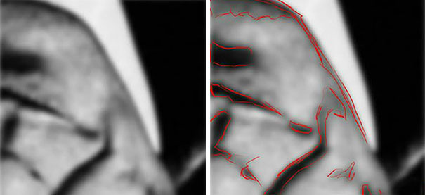 Artist Points Out The Mistakes Beginner Artists Make Because They Draw With Their Brain, Not Their Eyes Artist Points Out The Mistakes Beginner Artists Make Because They Draw With Their Brain, Not Their Eyes