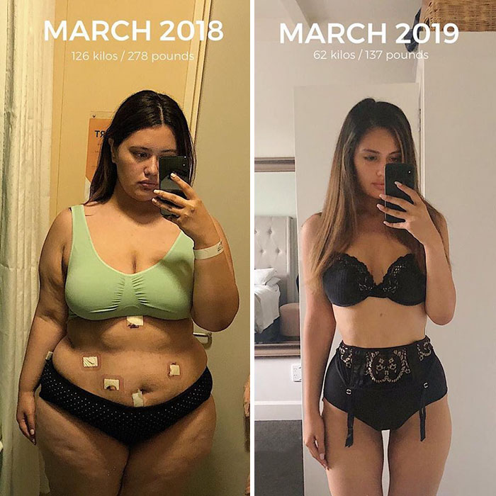 Woman Reveals Before-And-After Pictures Of Her 141-Pound Weight Loss, And She’s Completely Transparent About It Woman Reveals Before-And-After Pictures Of Her 141-Pound Weight Loss, And She’s Completely Transparent About It