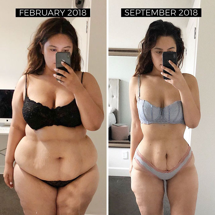 Woman Reveals Before-And-After Pictures Of Her 141-Pound Weight Loss, And She’s Completely Transparent About It Woman Reveals Before-And-After Pictures Of Her 141-Pound Weight Loss, And She’s Completely Transparent About It