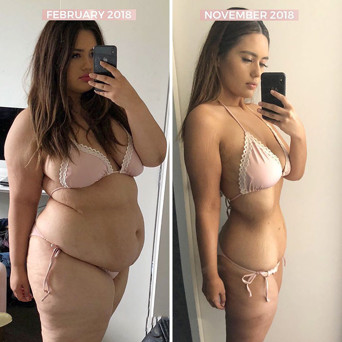 Woman Reveals Before-And-After Pictures Of Her 141-Pound Weight Loss, And She’s Completely Transparent About It Woman Reveals Before-And-After Pictures Of Her 141-Pound Weight Loss, And She’s Completely Transparent About It