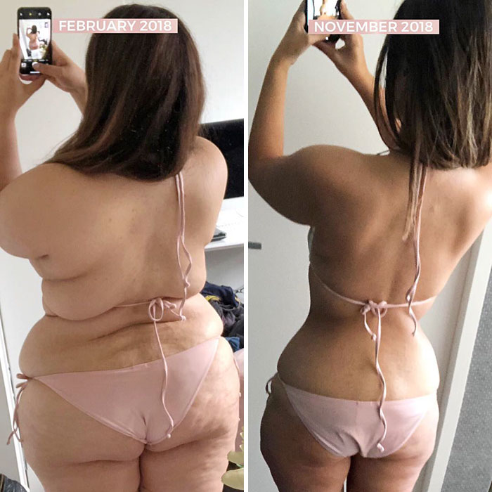 Woman Reveals Before-And-After Pictures Of Her 141-Pound Weight Loss, And She’s Completely Transparent About It Woman Reveals Before-And-After Pictures Of Her 141-Pound Weight Loss, And She’s Completely Transparent About It