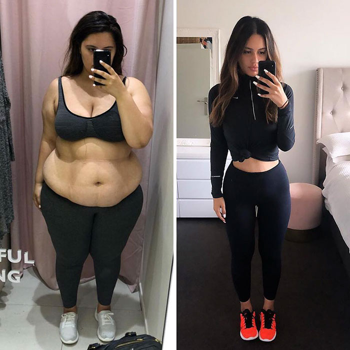 Woman Reveals Before-And-After Pictures Of Her 141-Pound Weight Loss, And She’s Completely Transparent About It Woman Reveals Before-And-After Pictures Of Her 141-Pound Weight Loss, And She’s Completely Transparent About It
