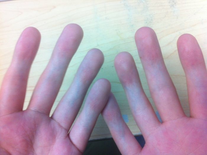 People Can&#8217;t Understand How This Guy Took A Photo Of Both Of His Hands, He Explains It With Even More &#8216;Unexplainable&#8217; Pictures