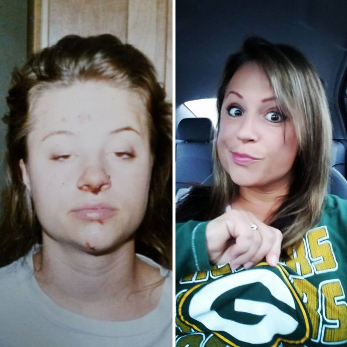 38 Stunning Before &#038; After Transformations Of People Who Quit Drugs