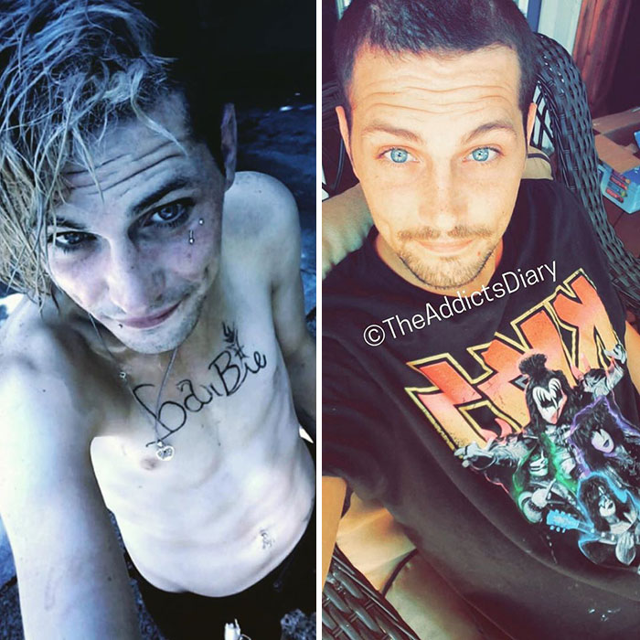 38 Stunning Before &#038; After Transformations Of People Who Quit Drugs