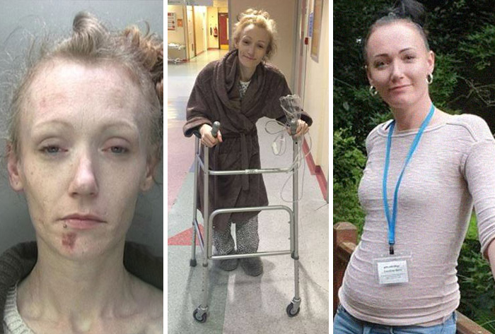 38 Stunning Before &#038; After Transformations Of People Who Quit Drugs